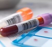 Prostatiidi laboratoorne diagnoosimine
